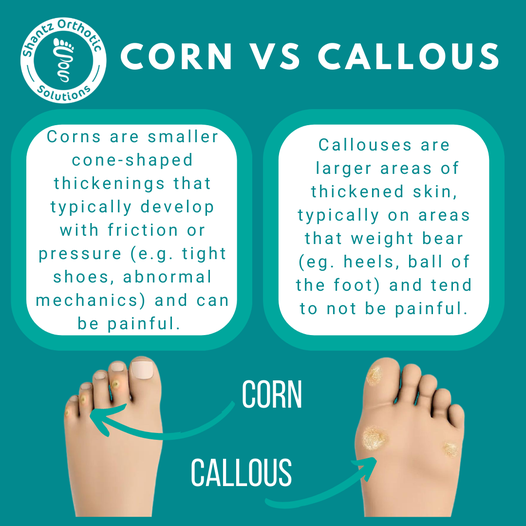 Corn vs Callous