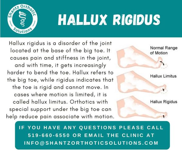 Hallux rigidus