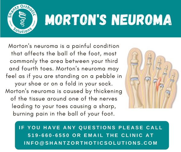 Morton’s Neuroma