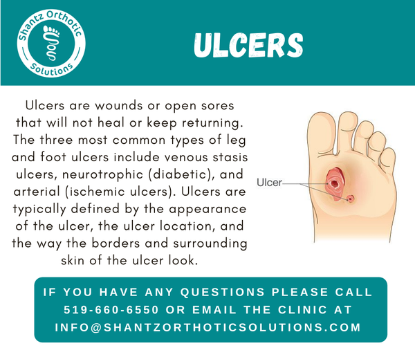 Ulcers