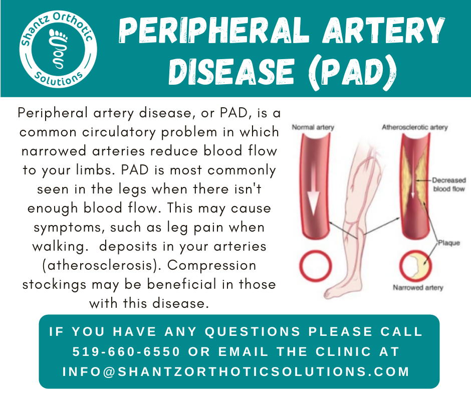 Peripheral Artery Disease (PAD)