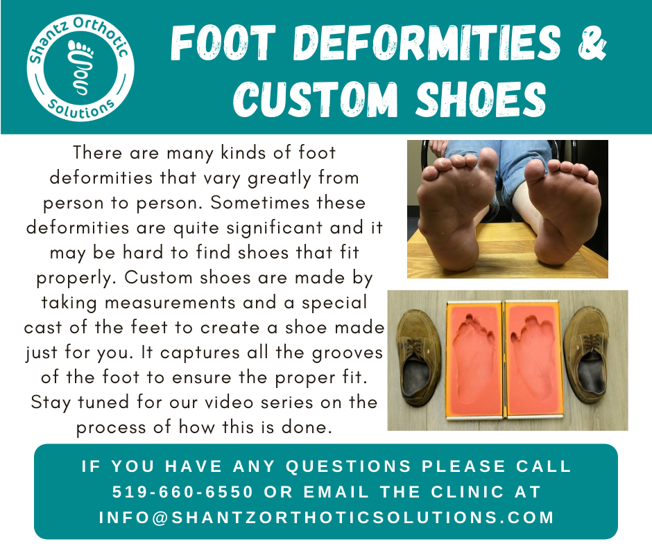 Foot Deformities and Custom Shoes